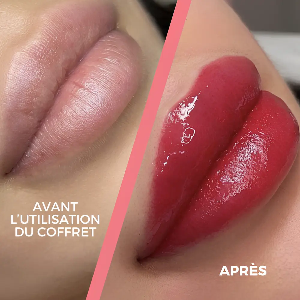 Candy Lips : tout ce qu&rsquo;il faut savoir avant de tenter l&rsquo;expérience
